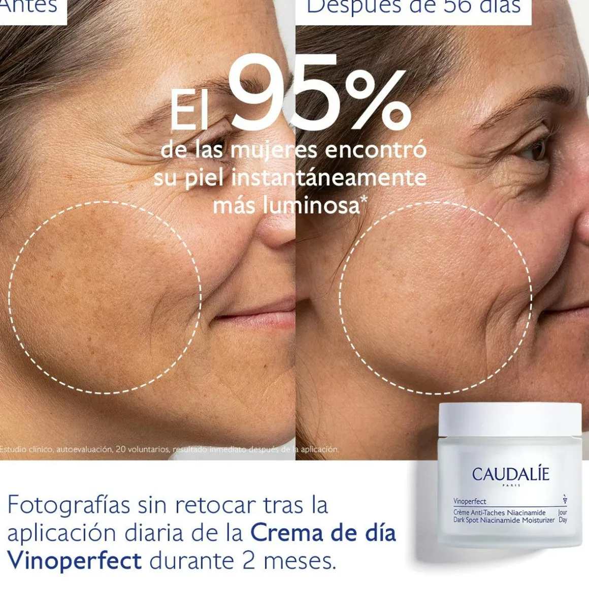 Crema Antimanchas Niacinamida
