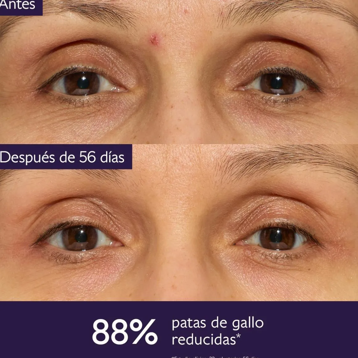 El Contorno de Ojos