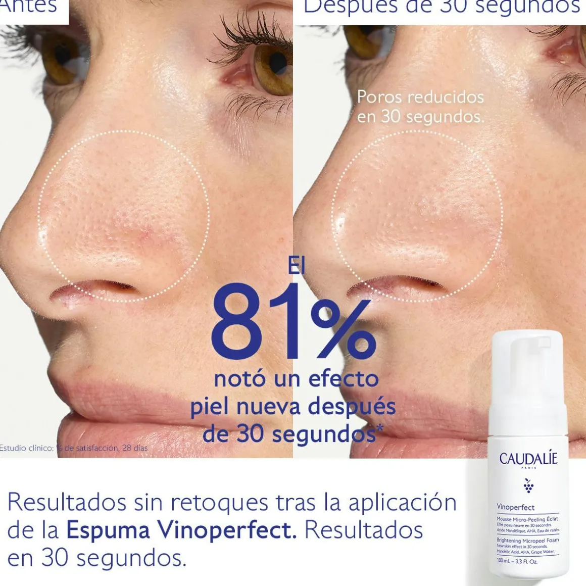 Espuma Micropeeling Luminosidad con Ácido Mandélico (AHA) - 100ml