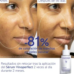 Sérum Resplandor Antimanchas con Viniferine, Alternativa a la Vitamina C - 30ml