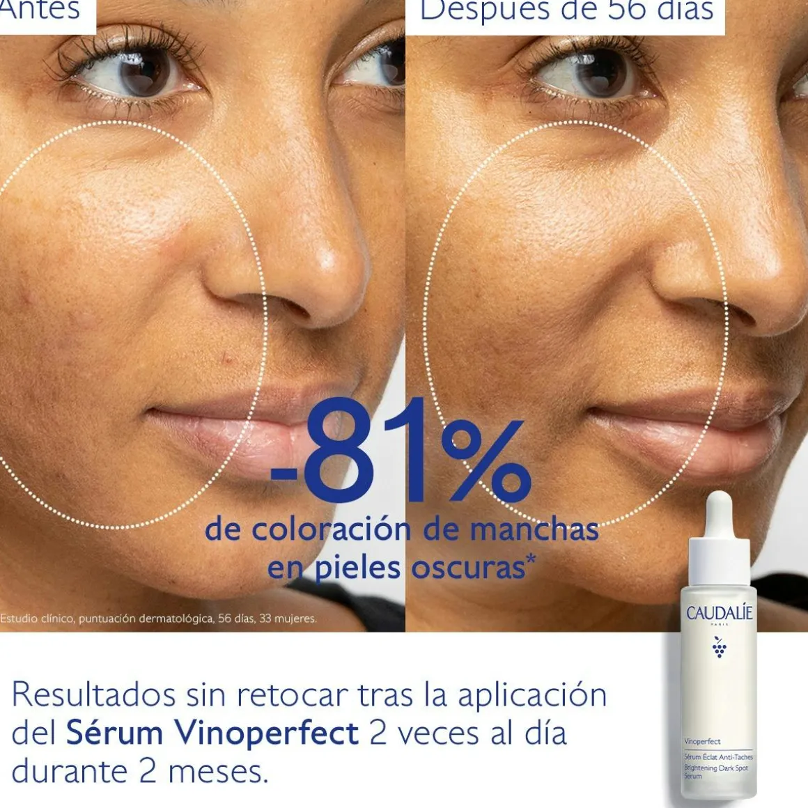 Sérum Resplandor Antimanchas con Viniferine, Alternativa a la Vitamina C - 50ml