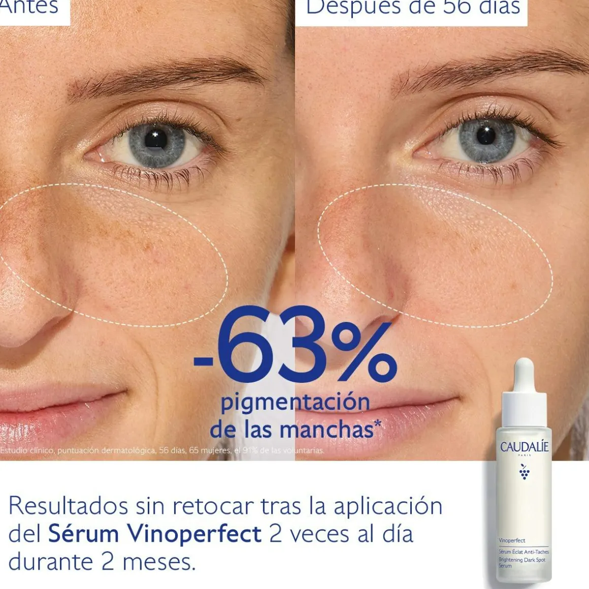 Sérum Resplandor Antimanchas con Viniferine, Alternativa a la Vitamina C - 50ml