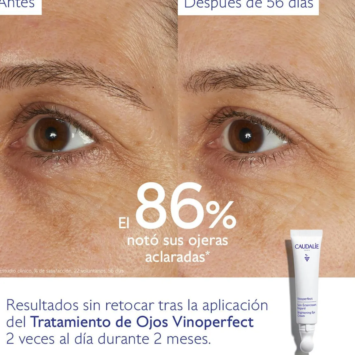 Tratamiento de Ojos Iluminador Nacinamida + Cafeína